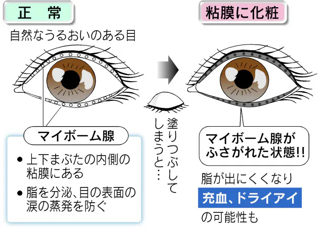 アイメークで瞳ぱっちり 目のトラブルに注意 Nikkei Style