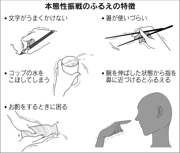手のふるえ 過度な不安 不要 Nikkei Style