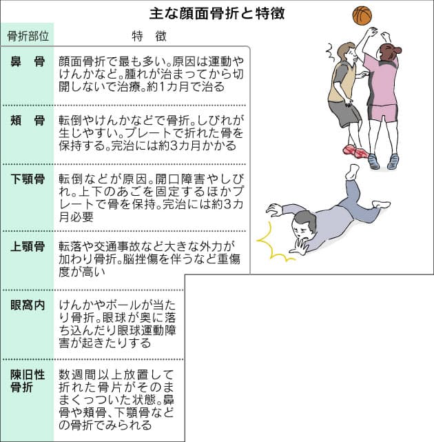 スポーツでの接触 酔って転倒 顔面骨折に注意 Nikkei Style スポーツでの接触 酔って転倒 顔面骨折に注意 Nikkei Style