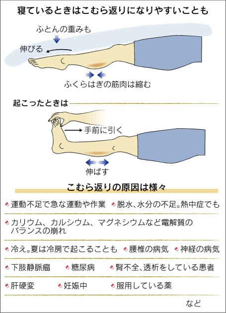こむら返り よく起こる人ご用心 病気や薬が原因のケースも Nikkei Style こむら返り よく起こる人ご用心 病気や薬が原因のケースも Nikkei Style