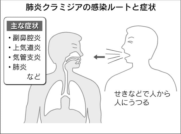クラミジアが肺炎の一因に 人のせき 鳥の世話で感染 Nikkei Style