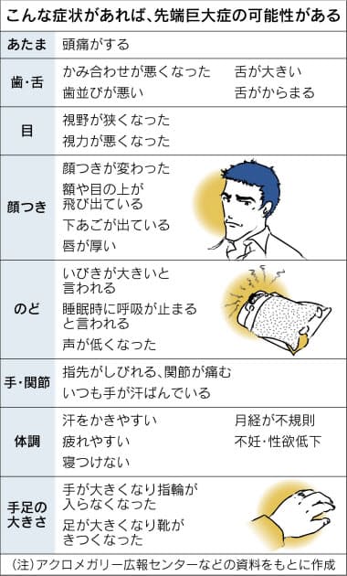 先端巨大症 成人後に過剰分泌 合併症招く 顔つき変貌 手足が肥大 ひどい いびき Nikkei Style 先端巨大症 成人後に過剰分泌 合併症招く 顔つき変貌 手足が肥大 ひどい いびき Nikkei Style