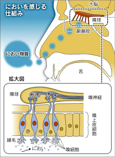 嗅覚障害 原因分かれば早期回復 内視鏡手術も普及 Nikkei Style