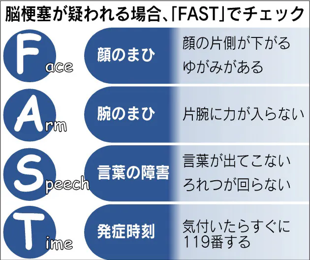 脳梗塞 若くても発症 チェックは Fast で Nikkei Style