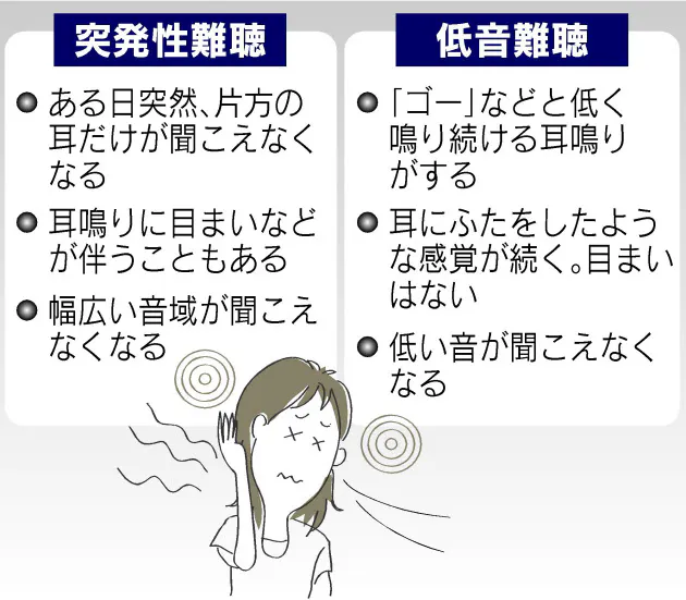 再生医療の研究進む ストレスが原因か 20 30代女性に増える低音難聴 Nikkei Style