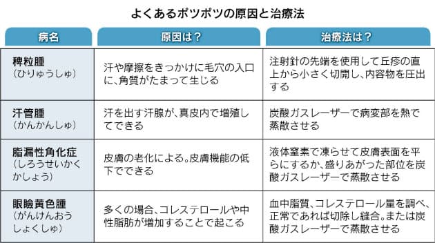どう対処 顔や首のポツポツ 自己処置は危険 Nikkei Style