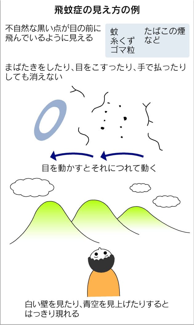 目の前を黒い点 飛蚊症 網膜に傷なら治療を Nikkei Style 目の前を黒い点 飛蚊症 網膜に傷なら治療を Nikkei Style
