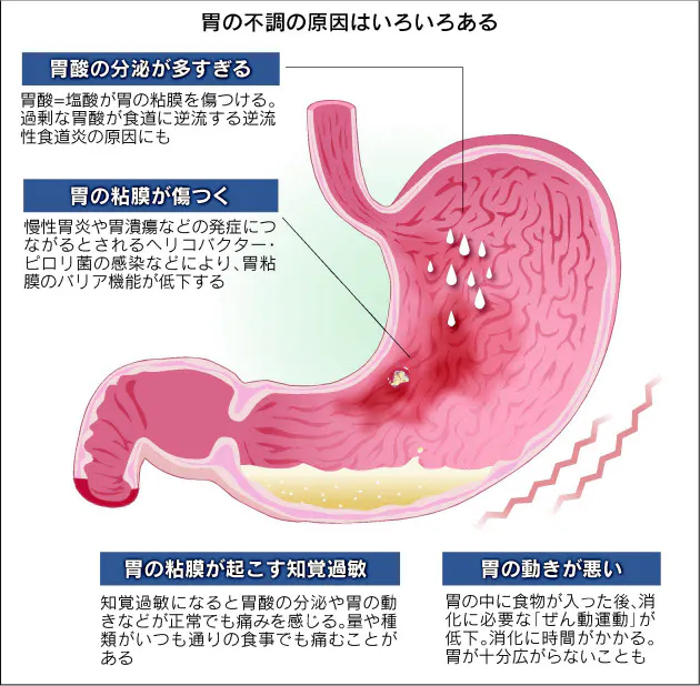 食欲不振 もたれ 胃の不調 甘く見ないで Nikkei Style