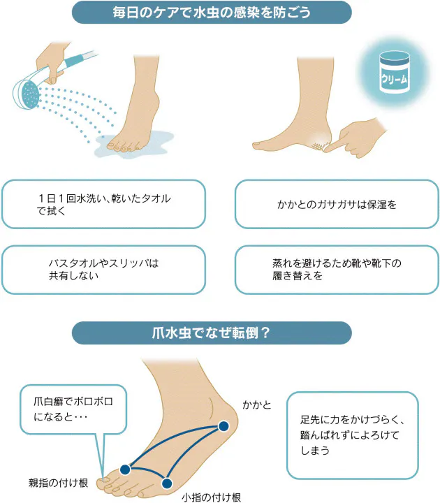 水虫で転倒しやすく 歩き方に異変 高齢者注意 Nikkei Style
