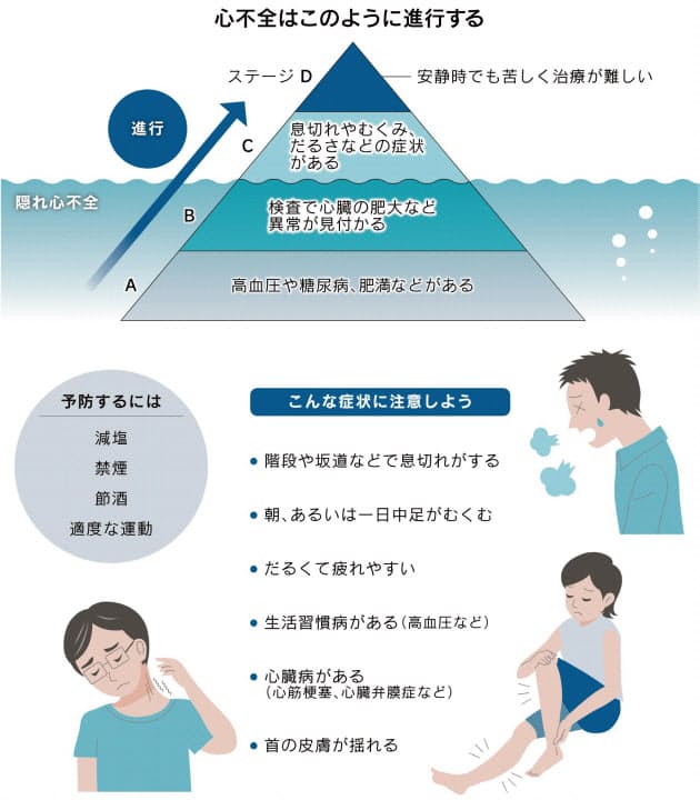 息切れやむくみ だるさ 意外に知らない心不全 Nikkei Style 息切れやむくみ だるさ 意外に知らない心不全 Nikkei Style
