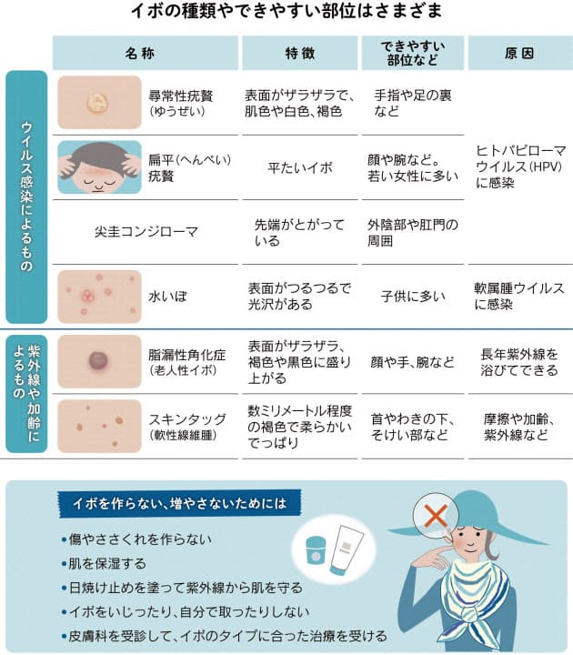 顔 手足のイボ 増えたり広がったりしたら Nikkei Style 顔 手足のイボ 増えたり広がったりしたら Nikkei Style