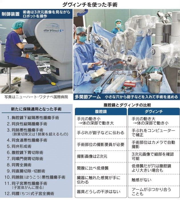 保険適用広がるロボット手術 得手不得手を知る Nikkei Style