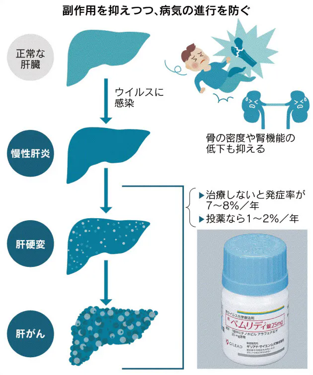 早期発見が課題 B型肝炎の新薬 ベムリディ 少量で副作用少なく Nikkei Style