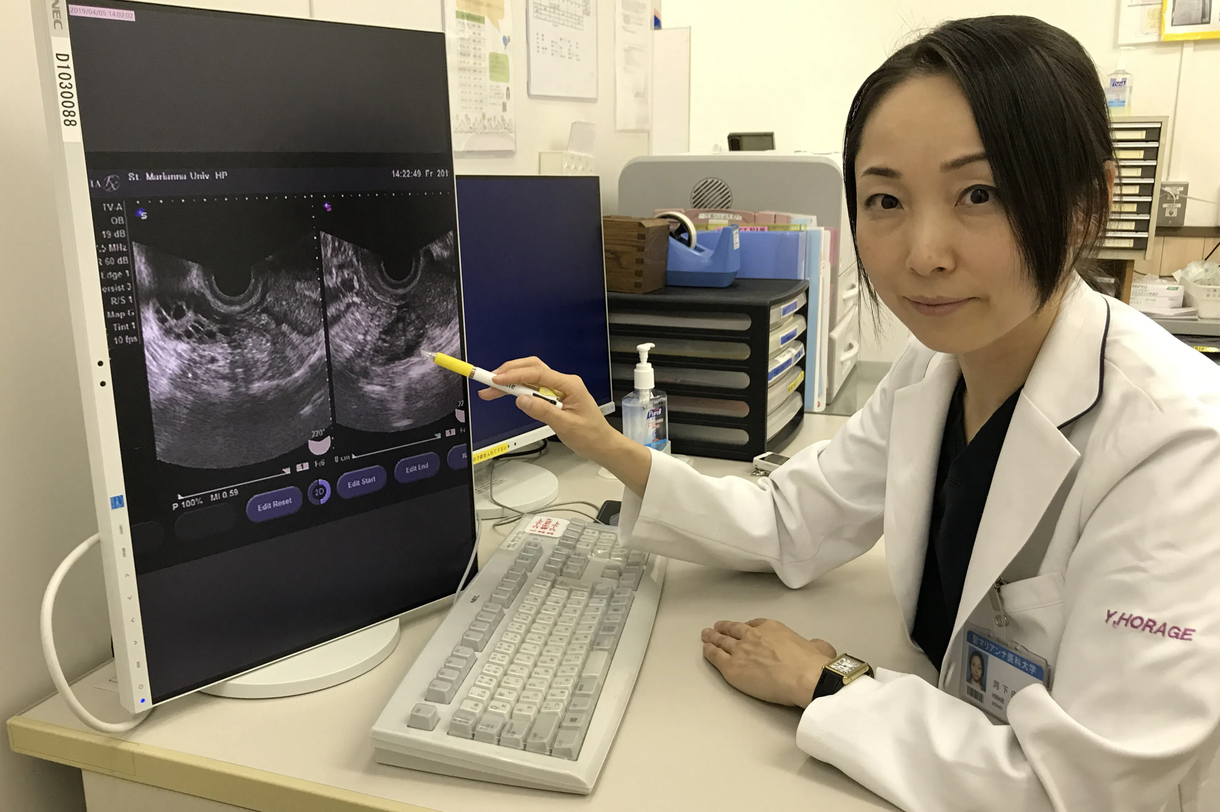 不妊リスク高める多嚢胞性卵巣症候群 肥満体質は注意 Nikkei Style