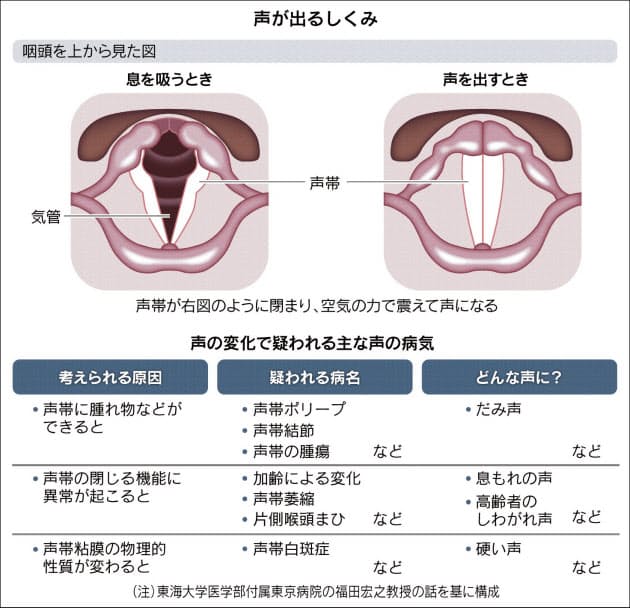 声の不調 長引くときは要注意 Nikkei Style 声の不調 長引くときは要注意 Nikkei Style