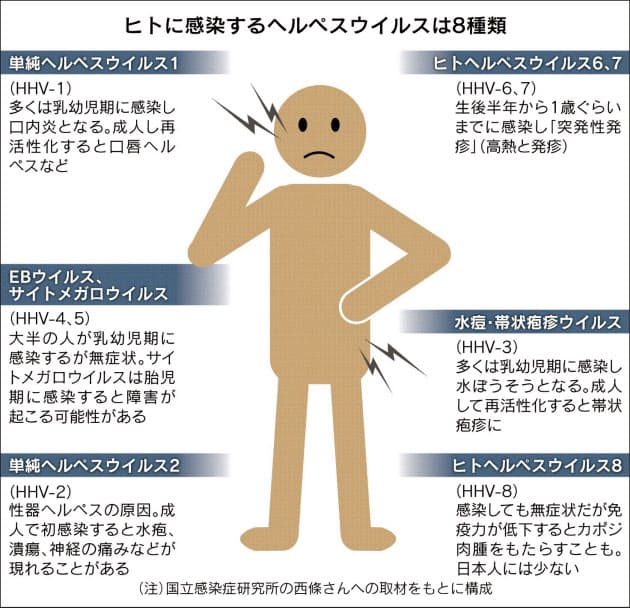 ヘルペス ヒトへの感染は8種類 妊婦は要注意 Nikkei Style ヘルペス ヒトへの感染は8種類 妊婦は要注意 Nikkei Style
