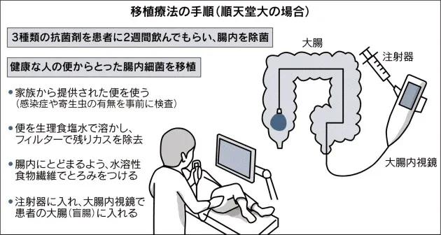 腸内細菌で体が変わる 移植で腸炎改善も Nikkei Style