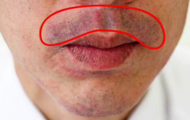 ヒゲそりで出血 腫れ物が カミソリ負けを防ぐ方法 Nikkei Style ヒゲそりで出血 腫れ物が カミソリ負けを防ぐ方法 Nikkei Style