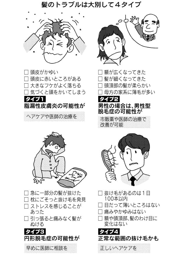 あなたの頭皮 大丈夫ですか 抜け毛が1日100本超えたら要注意 Nikkei Style あなたの頭皮 大丈夫ですか 抜け毛が1日100本超えたら要注意 Nikkei Style