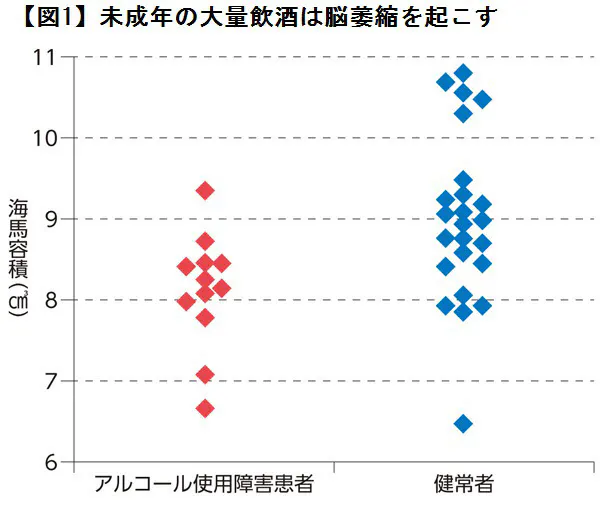 未成年の飲酒は脳にダメージが なぜお酒は20歳から 侮れない未成年の飲酒リスク Nikkei Style