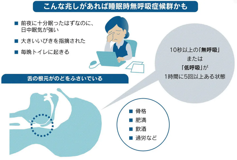 仕事中眠い もしかして 睡眠時無呼吸症候群かも Nikkei Style