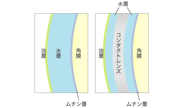 コンタクトレンズやゴミで 角膜に傷 コンタクトやitによるドライアイ 点眼薬で角 Nikkei Style