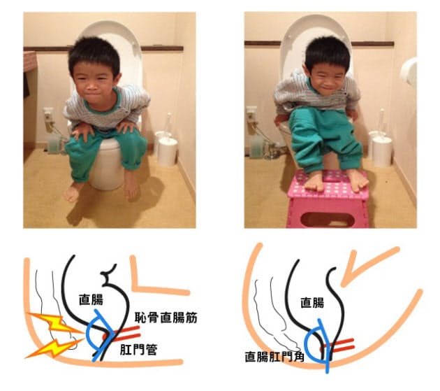 乳製品やお水をとっても良くならない 子どもの便秘の悩み 水分とるよりトイレの姿 Nikkei Style 乳製品やお水をとっても良くならない 子どもの便秘の悩み 水分とるよりトイレの姿 Nikkei Style