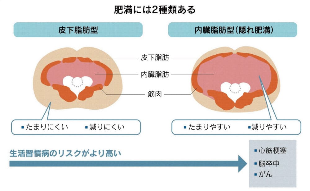 隠れ肥満にご用心 内臓脂肪リスク 細切れ運動で予防 Nikkei Style