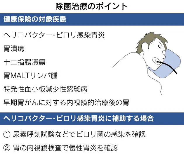 ピロリ菌 除菌治療後も要注意 残る胃がんリスク Nikkei Style