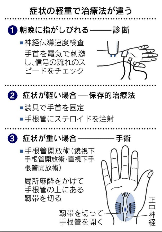 指のしびれ 手根管症候群 かも 老化と勘違い Nikkei Style 指のしびれ 手根管症候群 かも 老化と勘違い Nikkei Style