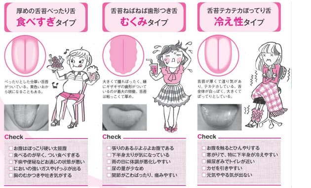 あなたのお腹はどのタイプ 舌で判断 漢方式で ぽっこりお腹 にサヨナラ Nikkei Style あなたのお腹はどのタイプ 舌で判断 漢方式で ぽっこりお腹 にサヨナラ Nikkei Style