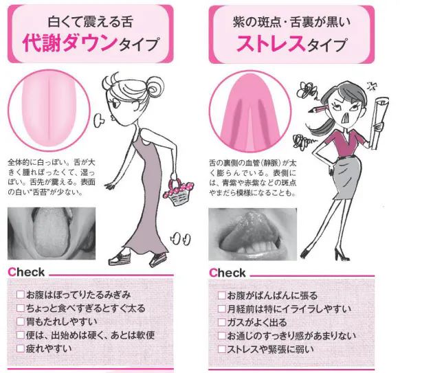 あなたのお腹はどのタイプ 舌で判断 漢方式で ぽっこりお腹 にサヨナラ Nikkei Style あなたのお腹はどのタイプ 舌で判断 漢方式で ぽっこりお腹 にサヨナラ Nikkei Style