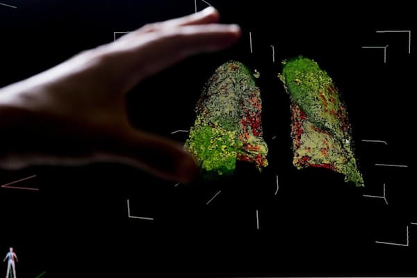 コロナと味覚の新関係 苦みに敏感なら感染しにくい Nikkei Style コロナと味覚の新関係 苦みに敏感なら感染しにくい Nikkei Style