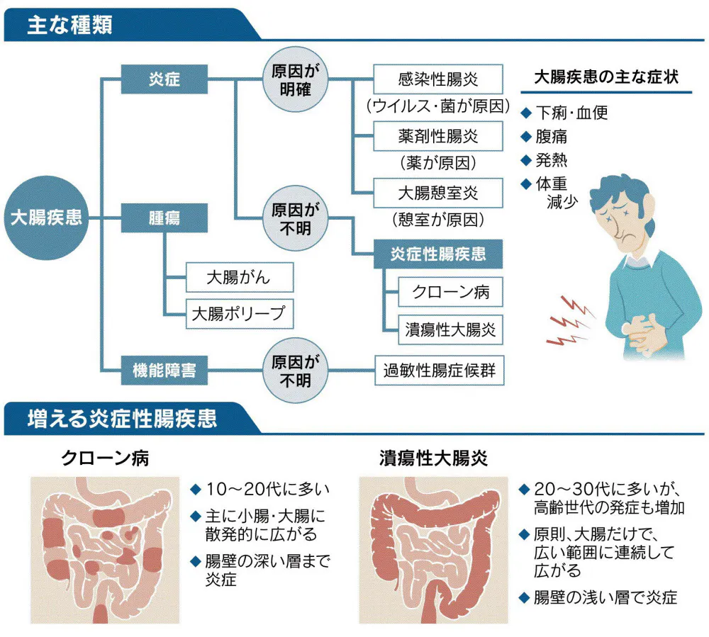 つらい腹痛 下痢 大腸疾患が中高年に増える理由 Nikkei Style