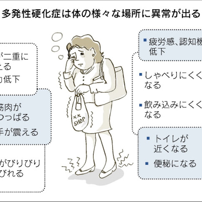 多発 性 硬化 症 寿命 性 症 寿命 硬化 多発