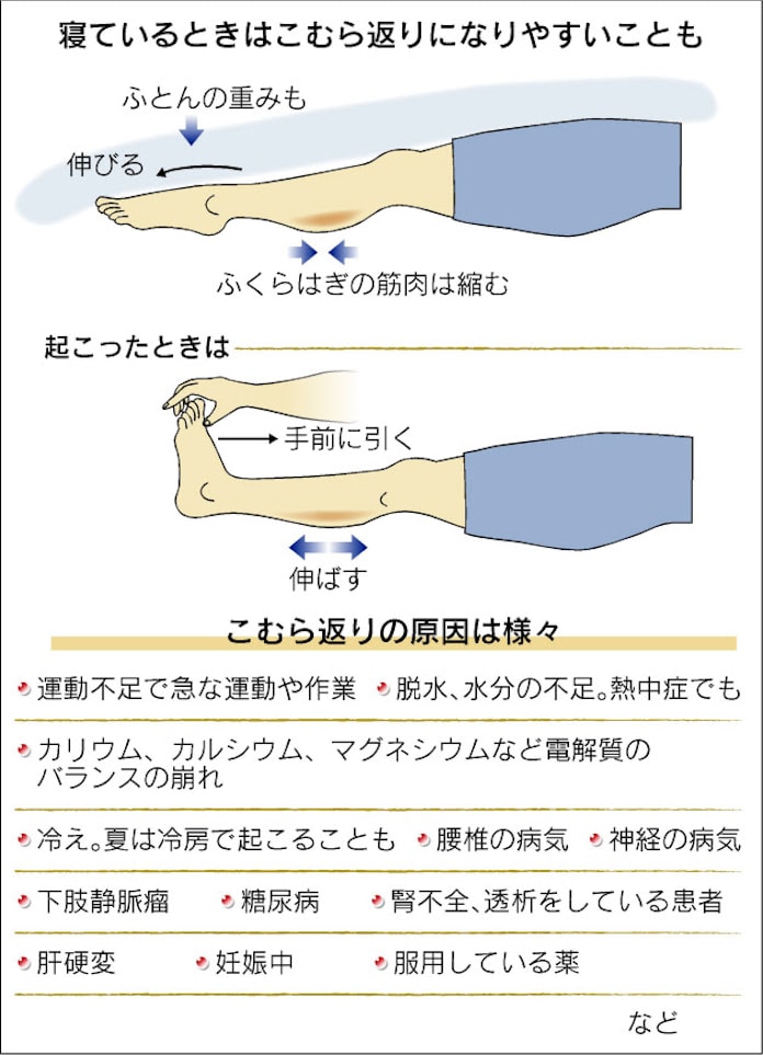 こむら返り よく起こる人ご用心 日本経済新聞 こむら返り よく起こる人ご用心 日本経済新聞