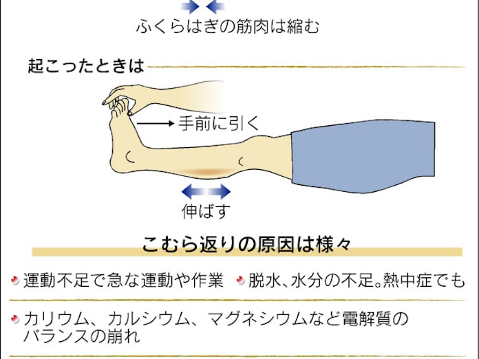 こむら返り よく起こる人ご用心 日本経済新聞 こむら返り よく起こる人ご用心 日本経済新聞