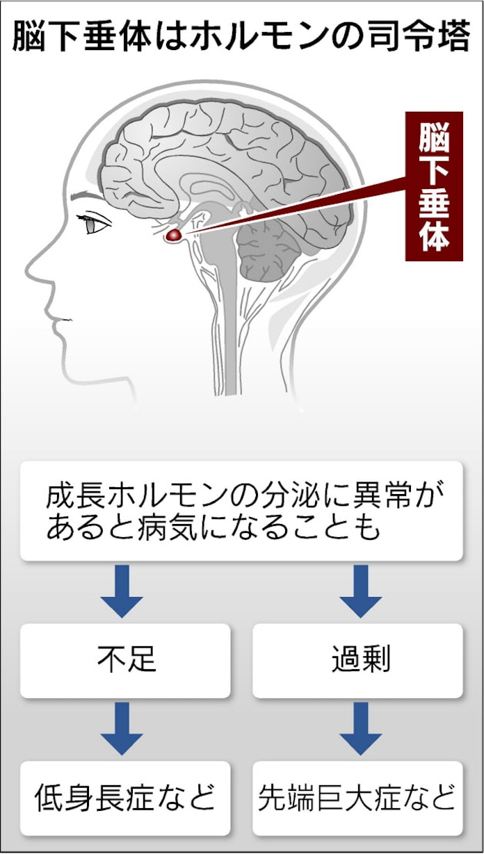 成長ホルモンの病気 下 極端な低身長 早期把握し治療 日本経済新聞 成長ホルモンの病気 下 極端な低身長 早期把握し治療 日本経済新聞