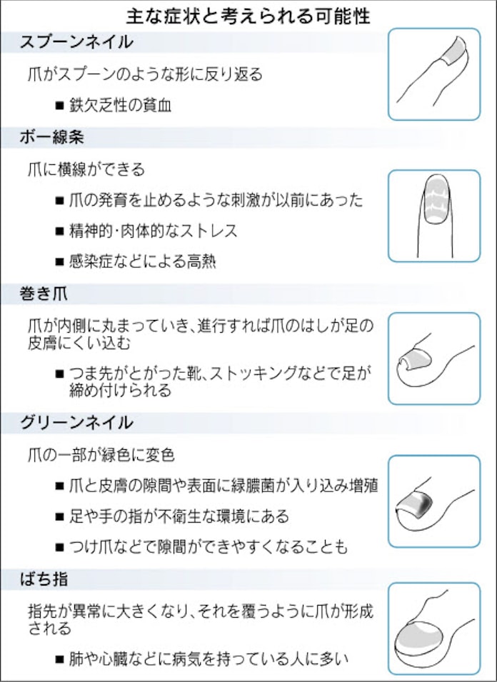 体のsos 爪でチェック 日本経済新聞 体のsos 爪でチェック 日本経済新聞