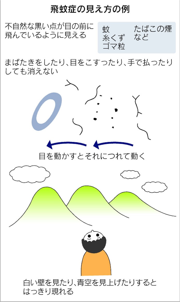 飛蚊症 網膜に傷なら治療 日本経済新聞 飛蚊症 網膜に傷なら治療 日本経済新聞