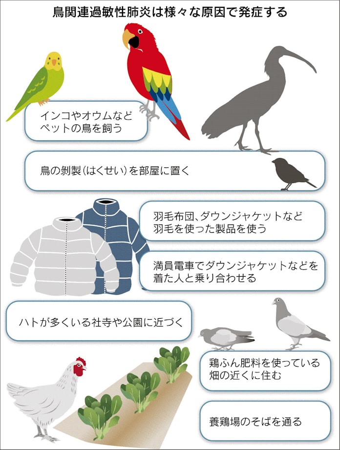 羽毛布団出したらコホッコホッ 熱も出た 鳥アレルギーの肺炎かも 日本経済新聞 羽毛布団出したらコホッコホッ 熱も出た 鳥アレルギーの肺炎かも 日本経済新聞