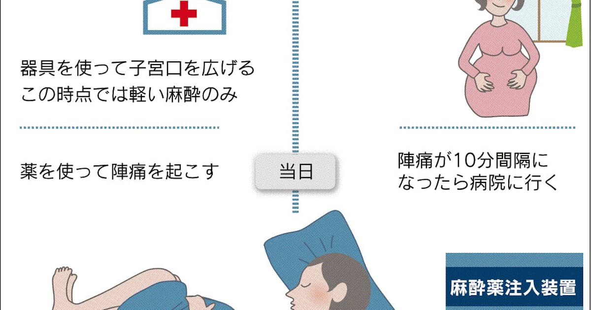 無痛分娩 広がる 日本経済新聞 無痛分娩 広がる 日本経済新聞