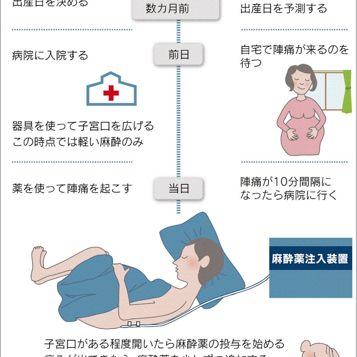 無痛分娩 広がる 日本経済新聞 無痛分娩 広がる 日本経済新聞