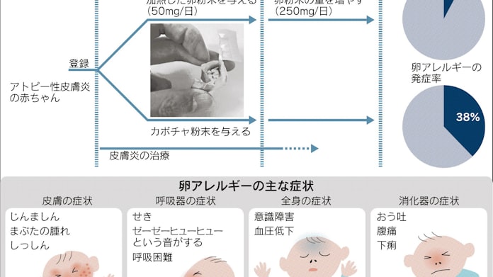 卵アレルギー 乳児から少量食べて予防 日本経済新聞 卵アレルギー 乳児から少量食べて予防 日本経済新聞