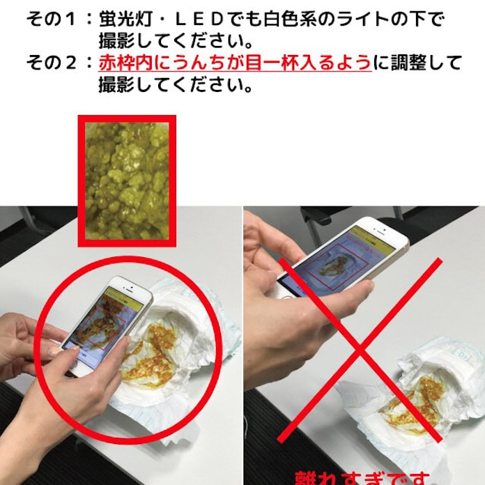 色 の 大腸 写真 癌 便 【大腸カメラ】前日の食事や下剤での便の変化を写真で紹介【体験談】