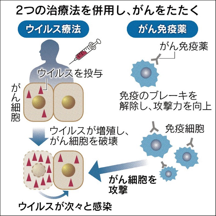 がん治療 ウイルス Aで 日本経済新聞