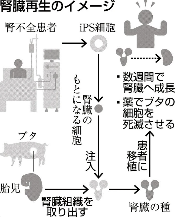 ブタ使って腎臓再生 日本経済新聞