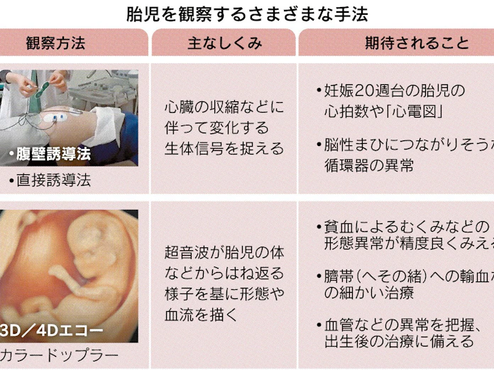 胎児の容体 いち早く把握 日本経済新聞 胎児の容体 いち早く把握 日本経済新聞