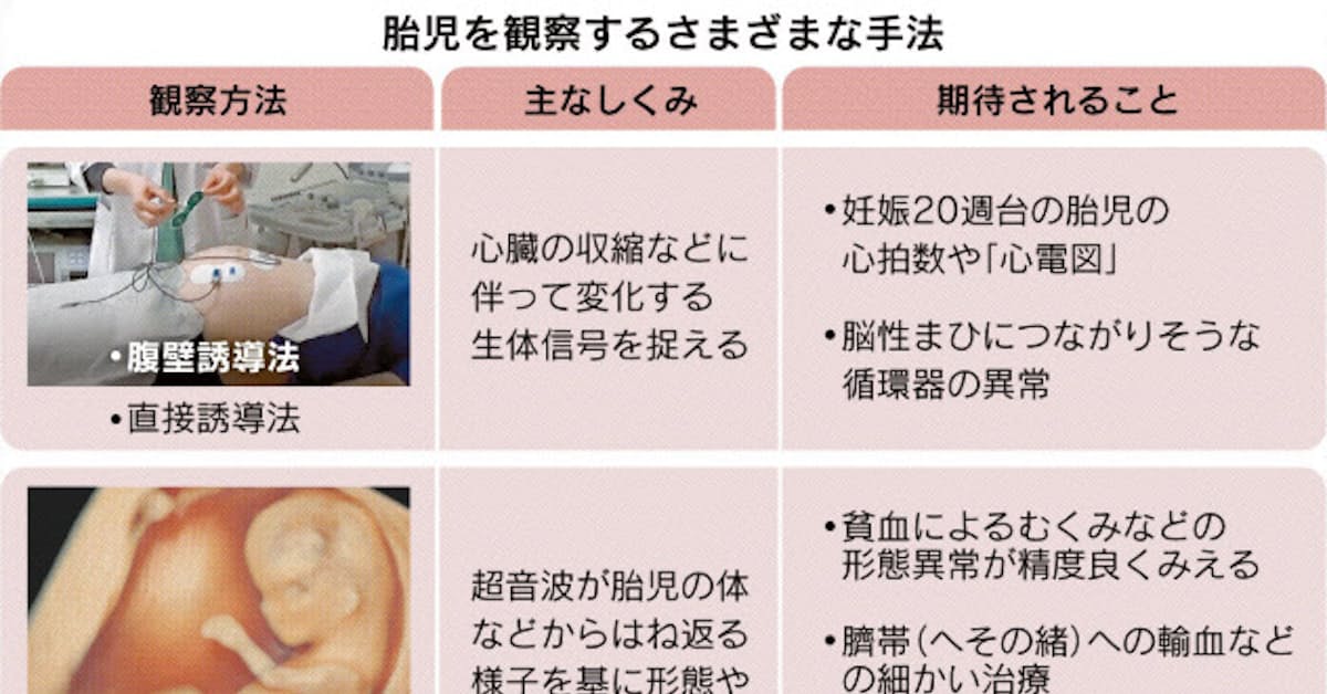 胎児の容体 いち早く把握 日本経済新聞