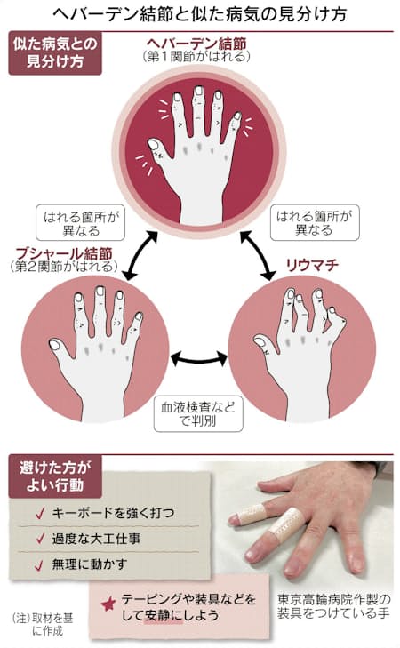 指の関節の痛み 重い病気かな と不安 日本経済新聞 指の関節の痛み 重い病気かな と不安 日本経済新聞